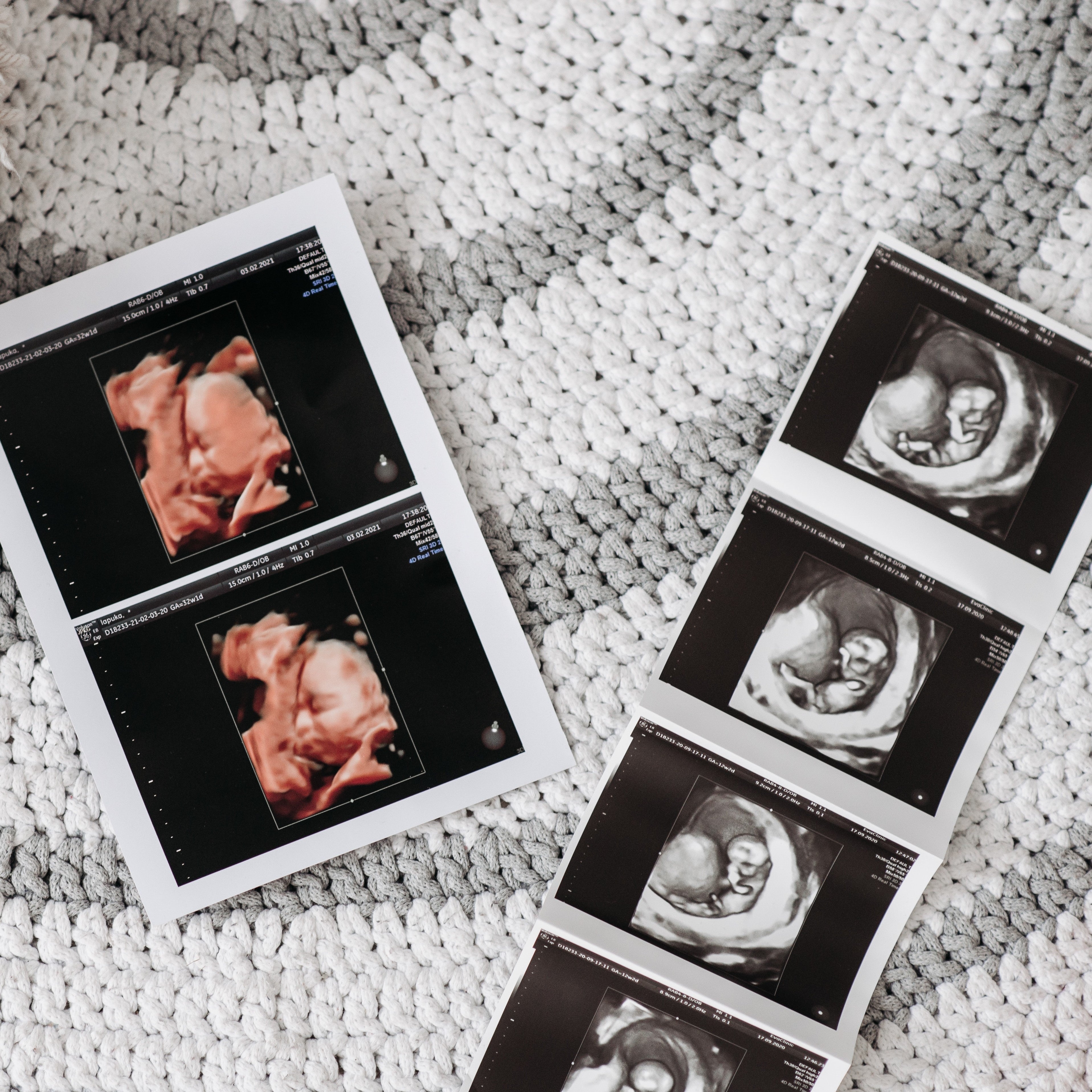 I'm pregnant, now what?